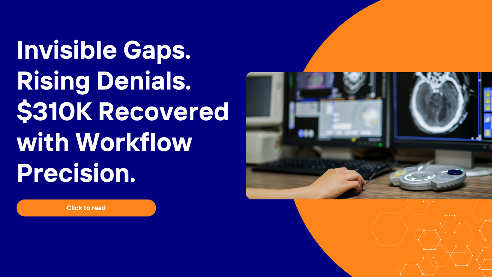 Invisible workflow gaps raising radiology claim denials